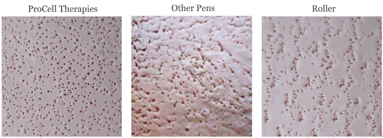 Procell Pattern