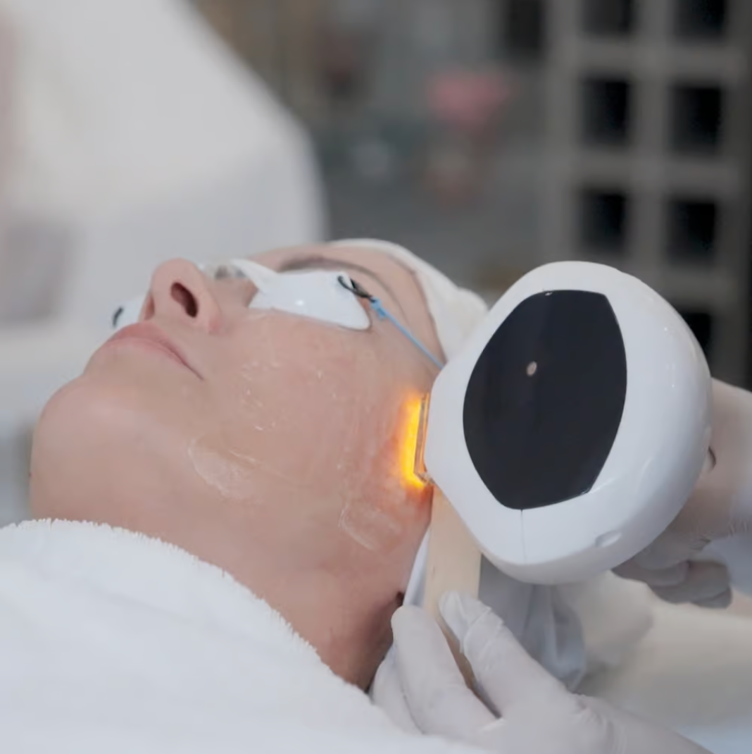 Lumecca IPL Facial